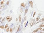 NUMA Antibody in Immunohistochemistry (IHC)