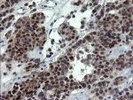 NUMB Antibody in Immunohistochemistry (Paraffin) (IHC (P))