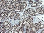 NUMB Antibody in Immunohistochemistry (Paraffin) (IHC (P))