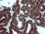 NUMB Antibody in Immunohistochemistry (Paraffin) (IHC (P))