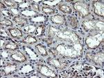 NUMB Antibody in Immunohistochemistry (Paraffin) (IHC (P))