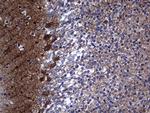 NUMB Antibody in Immunohistochemistry (Paraffin) (IHC (P))