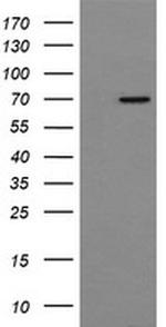 NUMB Antibody in Western Blot (WB)