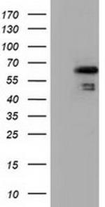 NUMB Antibody in Western Blot (WB)