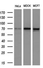NUMB Antibody in Western Blot (WB)