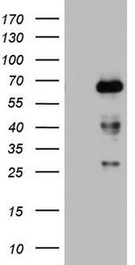 NUMB Antibody in Western Blot (WB)