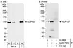 NUP107 Antibody in Western Blot (WB)