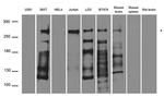 NUP214 Antibody in Western Blot (WB)