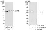 NUP50 Antibody in Western Blot (WB)