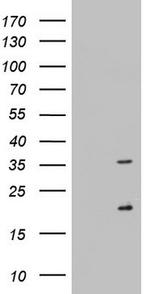 NUS1 Antibody in Western Blot (WB)