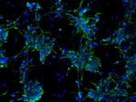 Nestin Antibody in Immunocytochemistry (ICC/IF)