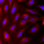 Nestin Antibody in Immunocytochemistry (ICC/IF)