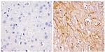 NEFH Antibody in Immunohistochemistry (Paraffin) (IHC (P))