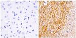 NEFH Antibody in Immunohistochemistry (Paraffin) (IHC (P))