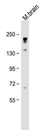 NEFH Antibody in Western Blot (WB)