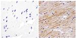 NEFL Antibody in Immunohistochemistry (Paraffin) (IHC (P))