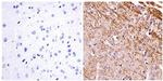 NEFL Antibody in Immunohistochemistry (Paraffin) (IHC (P))