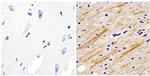 NEFM Antibody in Immunohistochemistry (Paraffin) (IHC (P))