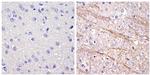 NEFM Antibody in Immunohistochemistry (Paraffin) (IHC (P))