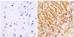 NEFM Antibody in Immunohistochemistry (Paraffin) (IHC (P))