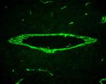 ZO-1 Antibody in Immunohistochemistry (IHC)