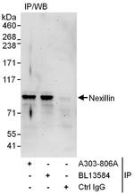 Nexilin Antibody in Immunoprecipitation (IP)