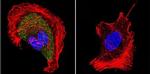 CHRNA1 Antibody in Immunocytochemistry (ICC/IF)