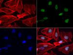 Nkx3.1 Antibody in Immunocytochemistry (ICC/IF)