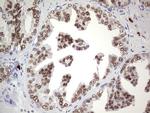 Nkx3.1 Antibody in Immunohistochemistry (Paraffin) (IHC (P))