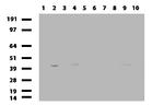 Nkx3.1 Antibody in Western Blot (WB)