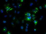 Noggin Antibody in Immunocytochemistry (ICC/IF)