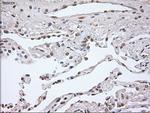 Noggin Antibody in Immunohistochemistry (Paraffin) (IHC (P))