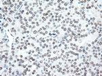 Noggin Antibody in Immunohistochemistry (Paraffin) (IHC (P))