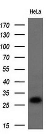 Noggin Antibody in Western Blot (WB)