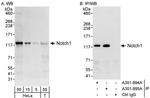 Notch1 Antibody in Western Blot (WB)