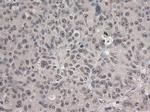 Notch1 Antibody in Immunohistochemistry (Paraffin) (IHC (P))