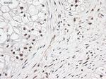 Notch1 Antibody in Immunohistochemistry (Paraffin) (IHC (P))