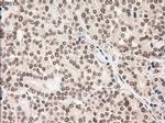 Notch1 Antibody in Immunohistochemistry (Paraffin) (IHC (P))