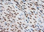 Notch1 Antibody in Immunohistochemistry (Paraffin) (IHC (P))