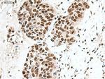 Notch1 Antibody in Immunohistochemistry (Paraffin) (IHC (P))