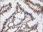 Notch1 Antibody in Immunohistochemistry (Paraffin) (IHC (P))