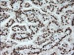 Notch1 Antibody in Immunohistochemistry (Paraffin) (IHC (P))