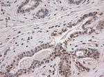 Notch1 Antibody in Immunohistochemistry (Paraffin) (IHC (P))