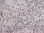 Notch1 Antibody in Immunohistochemistry (Paraffin) (IHC (P))