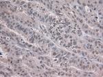 Notch1 Antibody in Immunohistochemistry (Paraffin) (IHC (P))