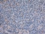 Notch1 Antibody in Immunohistochemistry (Paraffin) (IHC (P))