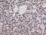 Notch1 Antibody in Immunohistochemistry (Paraffin) (IHC (P))