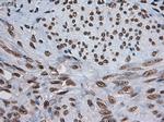 Notch1 Antibody in Immunohistochemistry (Paraffin) (IHC (P))