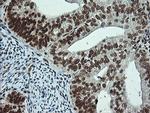 Notch1 Antibody in Immunohistochemistry (Paraffin) (IHC (P))