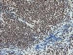 Notch1 Antibody in Immunohistochemistry (Paraffin) (IHC (P))